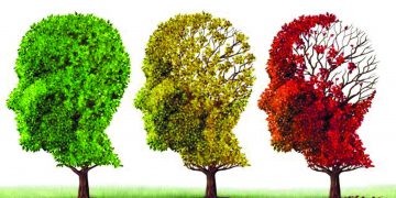 alzheimer3