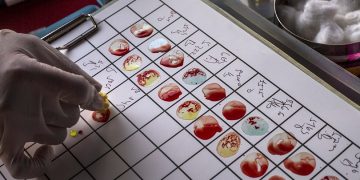 w09 91626bloodtest800454